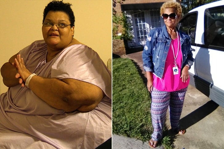 What these stars from 'My 600-lb' Life looks like today - Page 11 of 31 ...