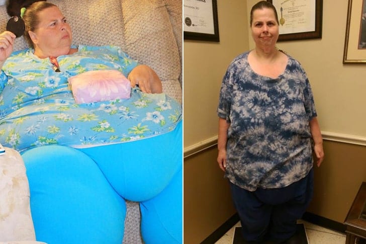 What these stars from 'My 600lb' Life looks like today