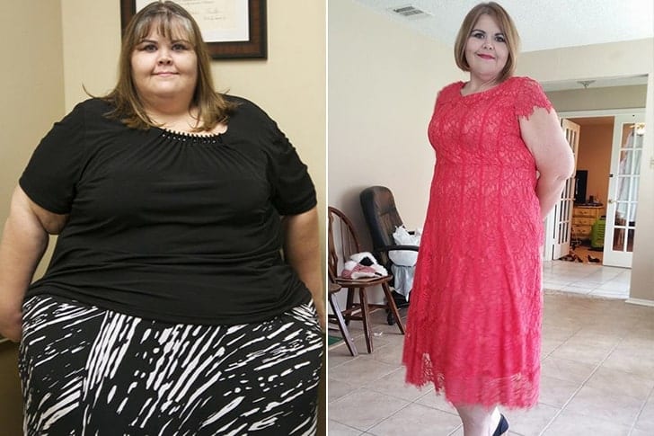 What these stars from 'My 600-lb' Life looks like today - Page 3 of 31 ...